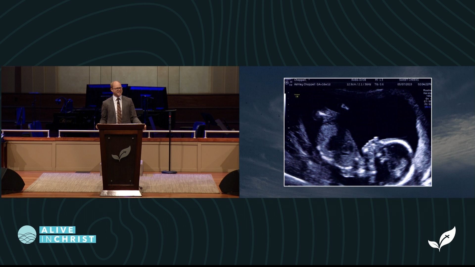 Larry Chappell: How God Sees The Unborn